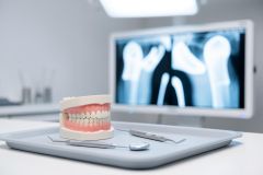 A detailed dental model and professional dental instruments sit on a tray in a bright, modern medical office. In the blurred background, a large monitor displays a medical X-ray, emphasizing a clinical healthcare and diagnostic environment with clean white and blue tones.