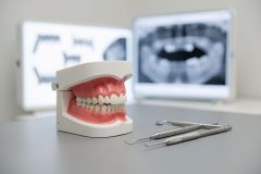 A professional dental clinic setup featuring a realistic human teeth and gums model on a clean desk. Beside the dental model are metal dental tools, such as a probe and mirror. In the background, two screens display dental X-ray scans, highlighting oral health diagnostics and professional dental care services.
