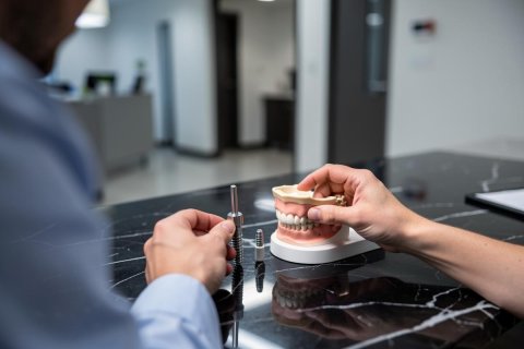 Comment fonctionne un implant dentaire ? Comprendre l’implant, le pilier et la couronne