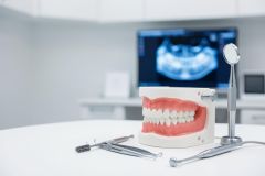 A detailed dental model of teeth and gums rests on a white surface alongside professional silver dental tools. The background features a blurred dental clinic environment with a digital panoramic X-ray visible on a computer monitor. This clean, bright image captures essential elements of oral healthcare and dentistry.