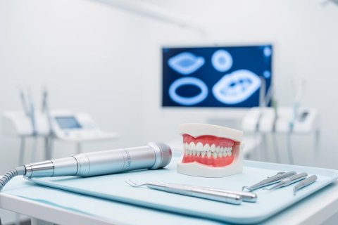 Remodelage gingival au laser ou au bistouri : précision, saignement, sutures, cicatrisation et prix