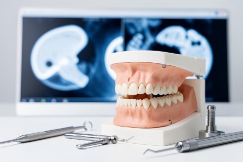A detailed dental model of human teeth and jaw sits on a white clinical surface surrounded by metal dental instruments. In the blurred background, a computer monitor displays blue-toned dental X-ray images, creating a professional medical atmosphere for oral health and dentistry services.