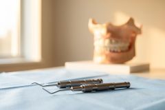 Pourquoi une greffe osseuse peut-elle être nécessaire avant un implant ? Perte osseuse, extraction et maladie parodontale
